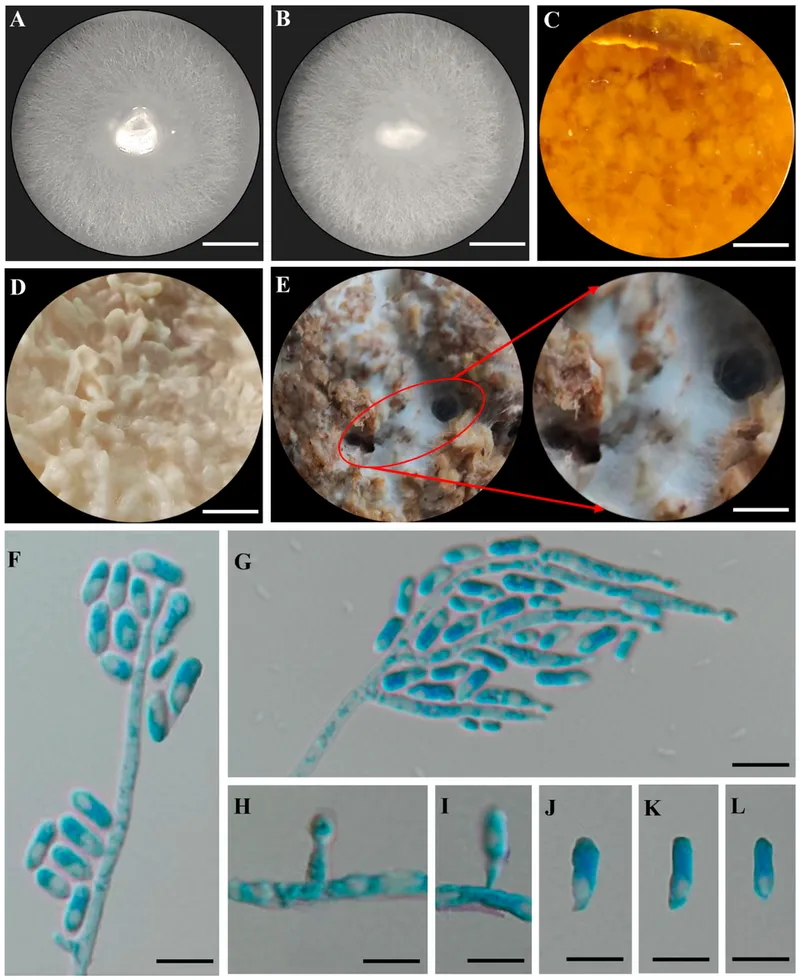 Laurel Wilt (Raffaelea lauricola) — lawn disease in Middle Tennessee