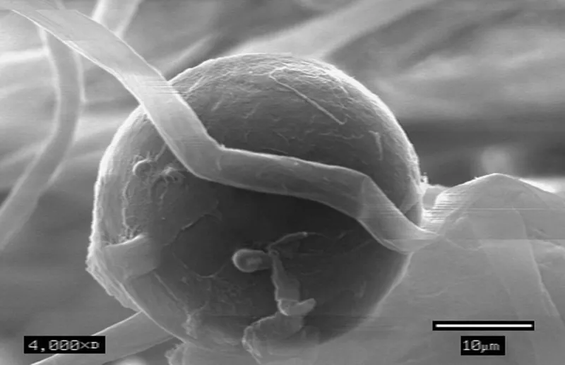 Phytophthora (N/A) — lawn disease in Middle Tennessee