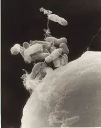 Crown Gall disease in Middle Tennessee