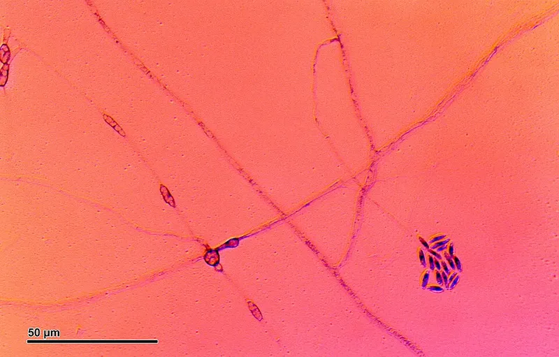 Pythium Blight turf disease in Middle Tennessee